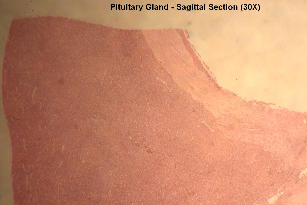 4 - Pituitary Gland 30X - 2
