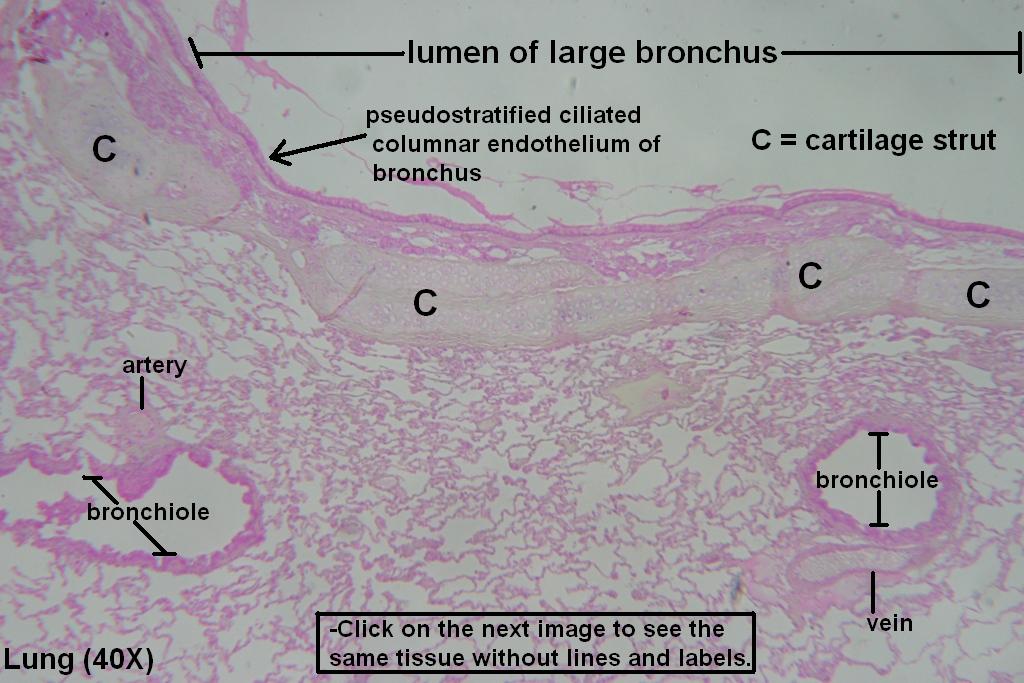 A - Bronchus and Bronchioles 40X - 1