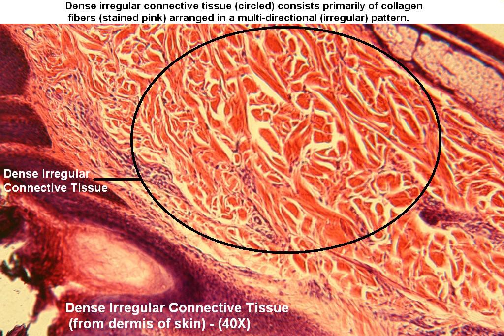 A Dense Irregular 40x 1