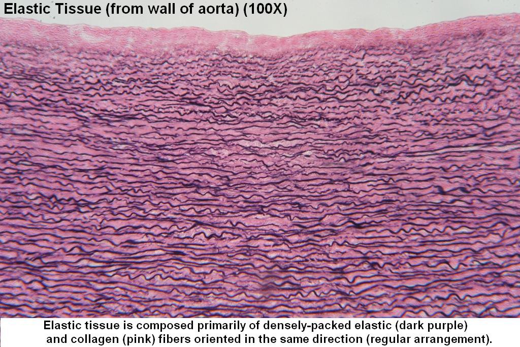A - Elastic Tissue 100X - 1