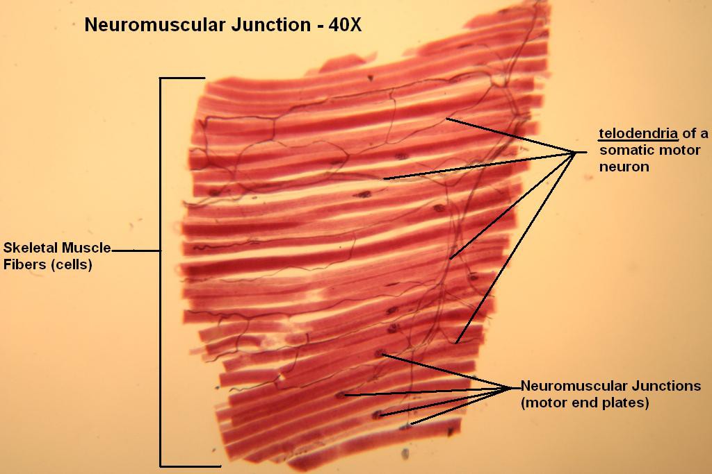 A - Neuromuscular Jxn 40X-1