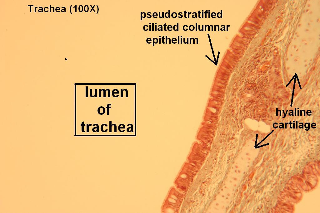A - Trachea 100X - 1