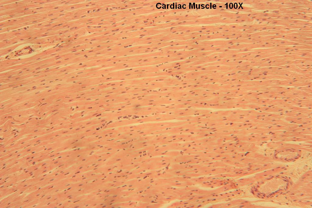 B - Cardiac Muscle  100X-2
