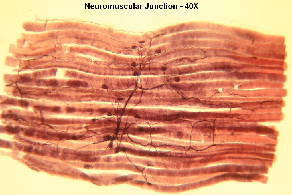 B - Neuromuscular Jxn 40X-2
