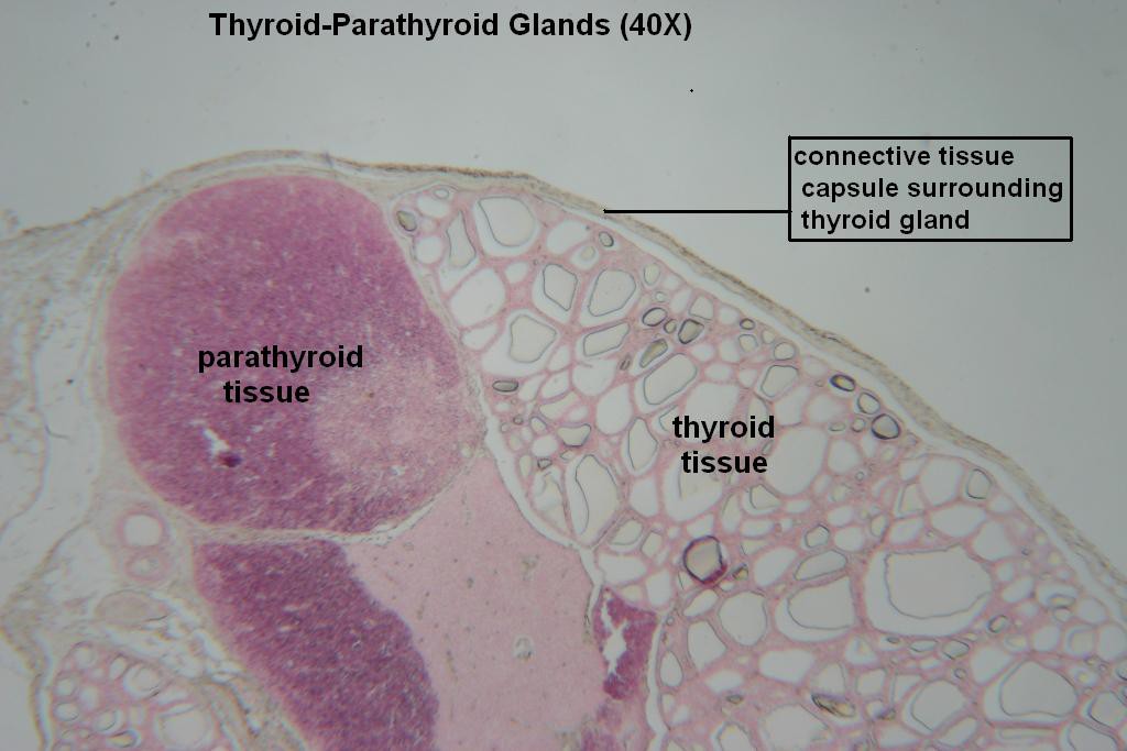 B - Thyroid-Parathyroid 40X - 2