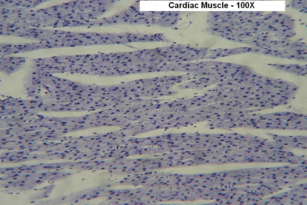 C - Cardiac Muscle 100X-3