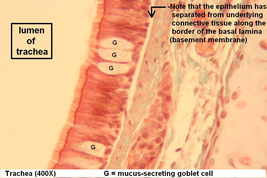 C - Pseudostratified Ciliated Columnar 400X - 2