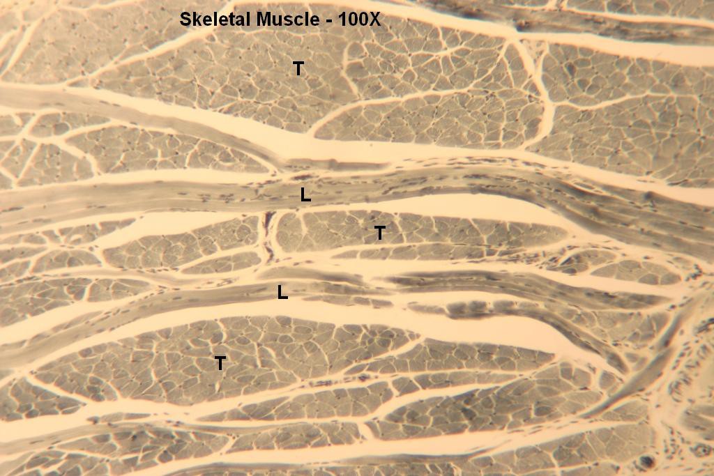 C - Skeletal Muscle 100X-3