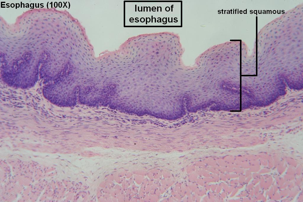 C - Stratified Squamous 100X - 1