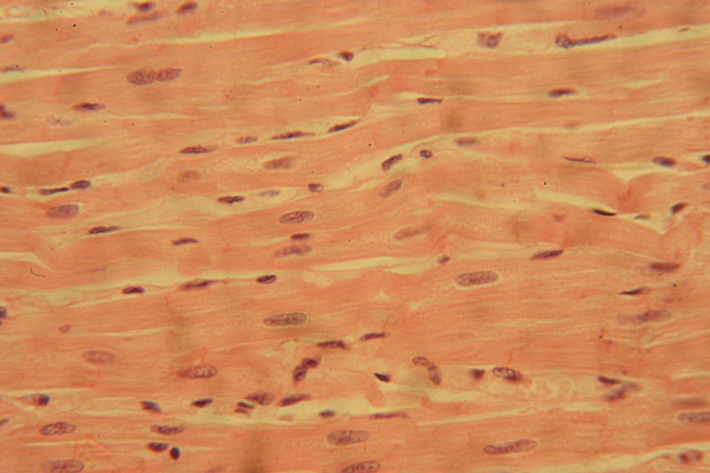 Cardiac Muscle 400X-14