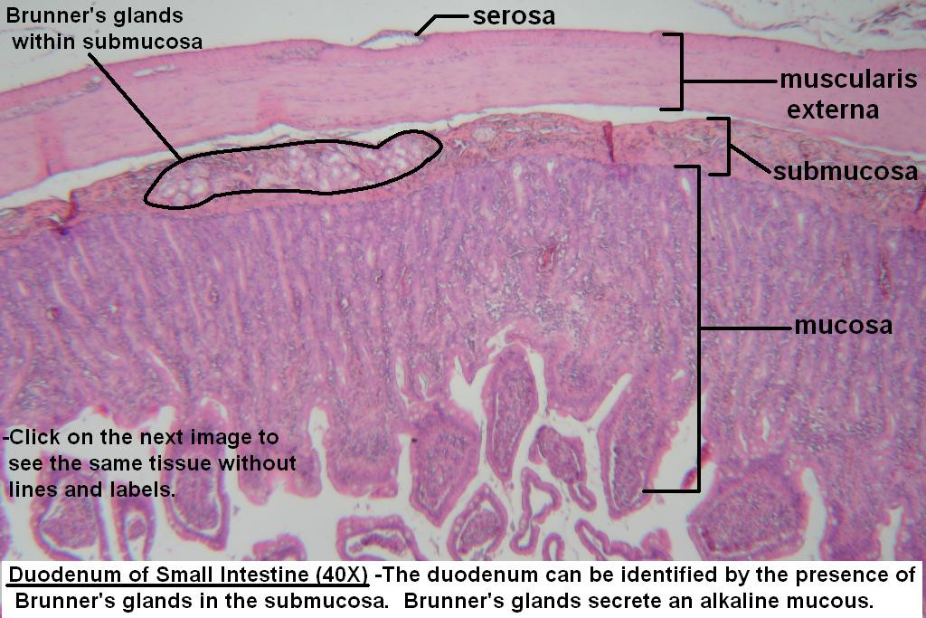 D - Duodenum Wall 40X - 1