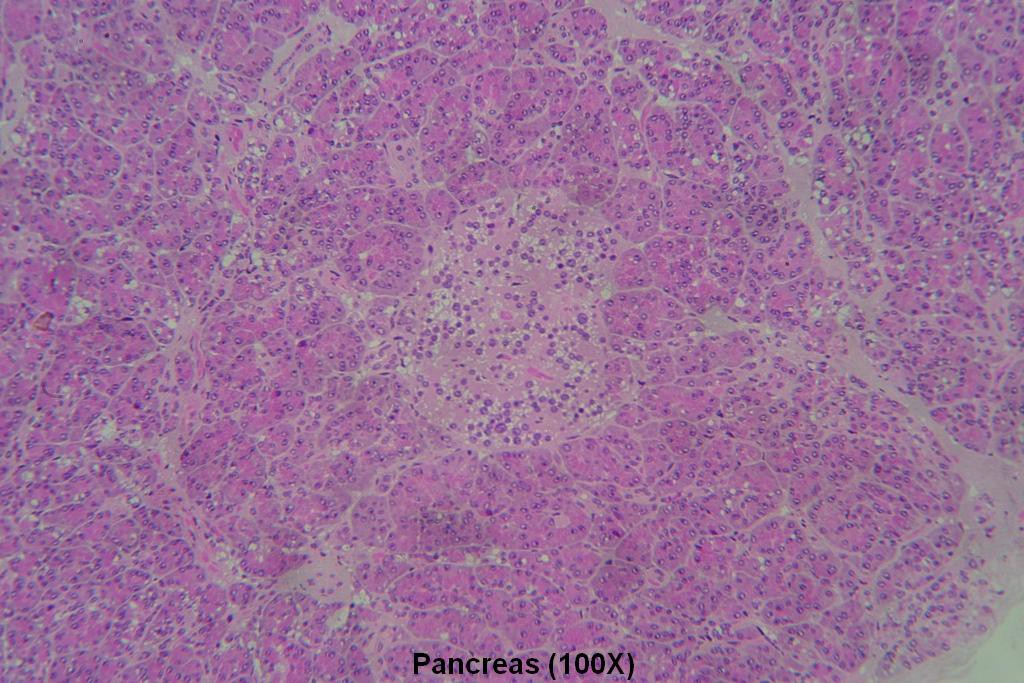 D - Pancreas 100X - 2