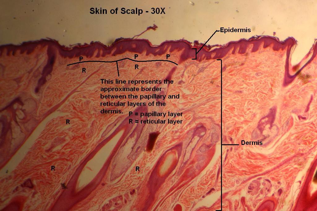 D - Scalp 30X-3-Layers of Dermis