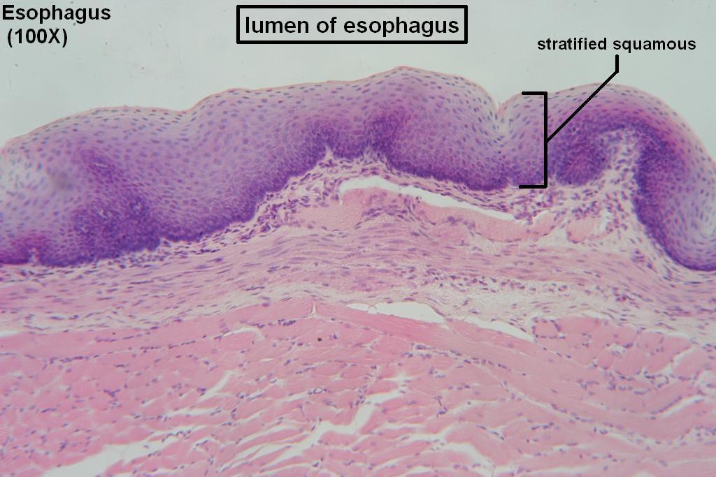 D - Stratified Squamous 100X - 2