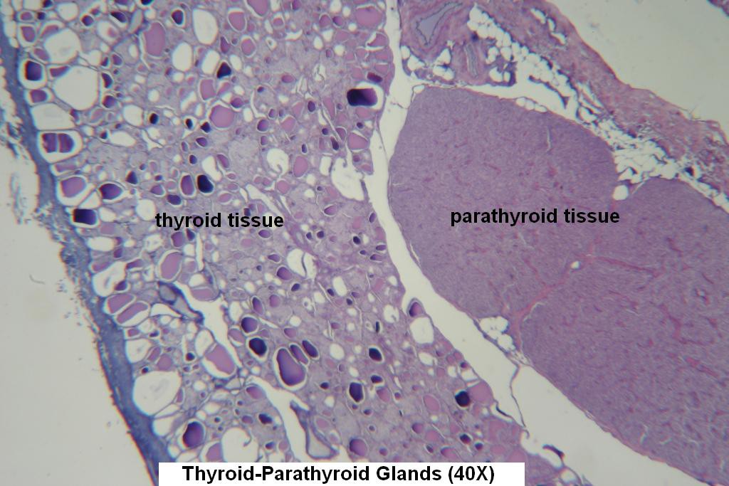 D - Thyroid-Parathyroid 40X - 4