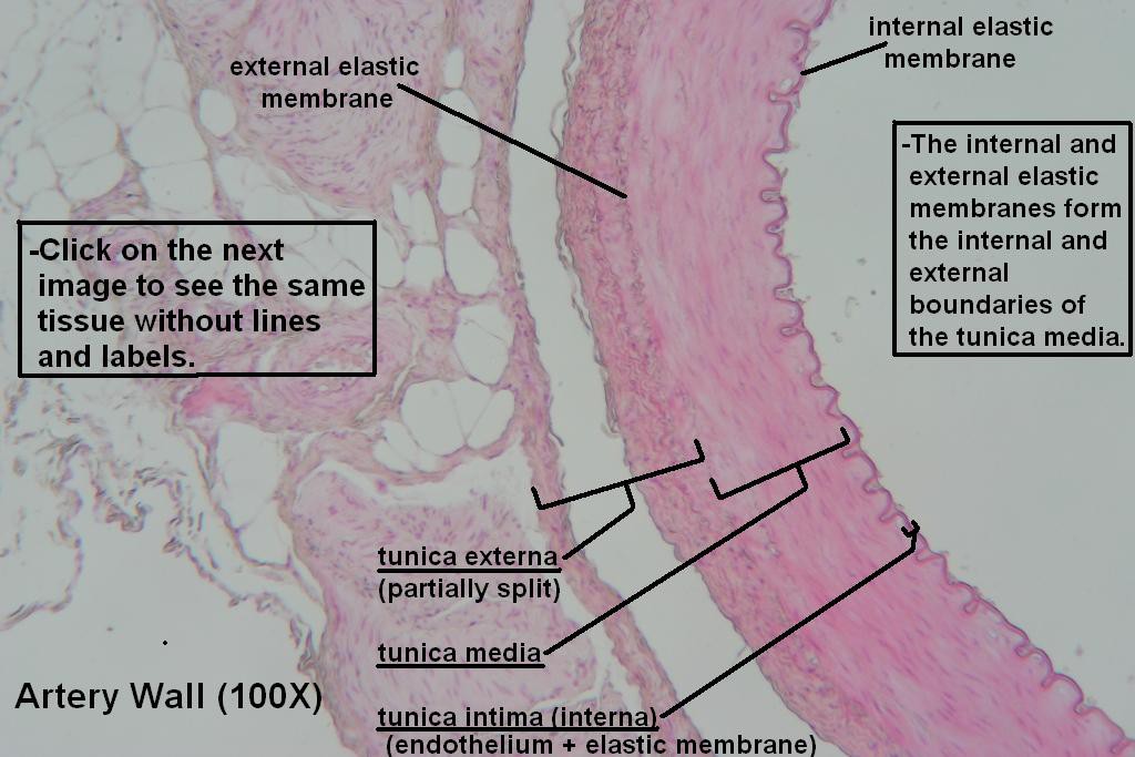 E - Artery Wall 100X - 1
