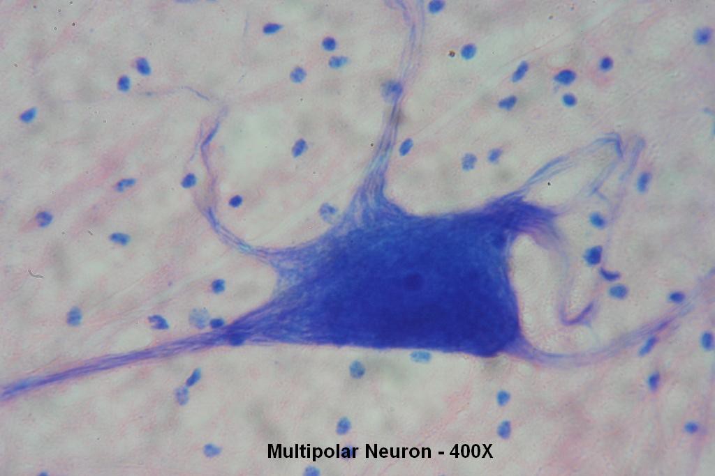 E - Multipolar Neurons 400X - 2
