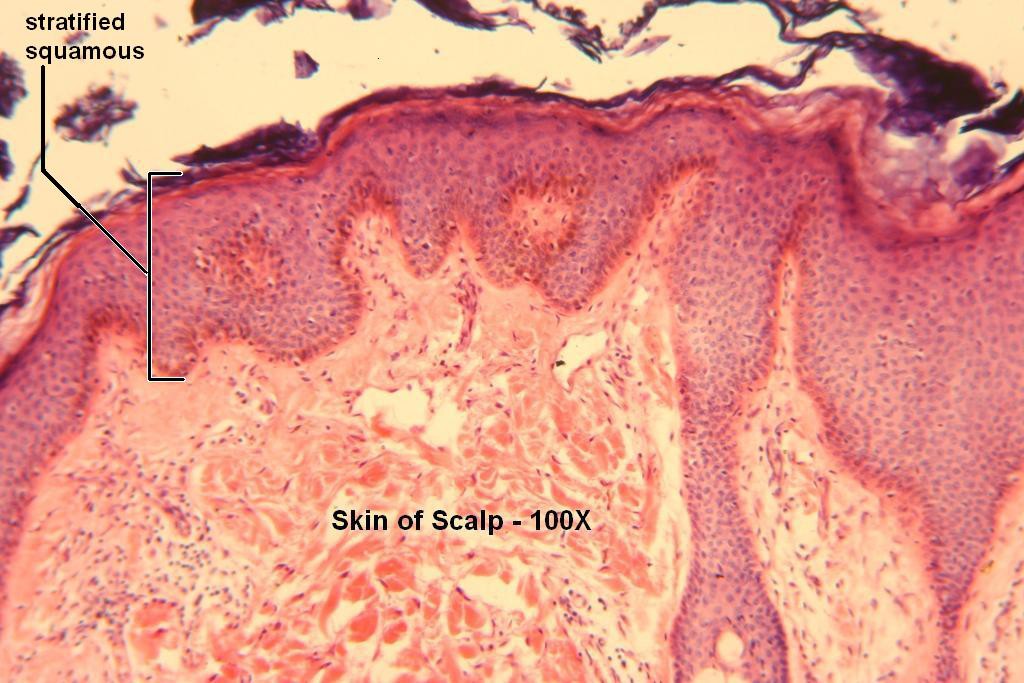 E - Stratified Squamous 100X - 3