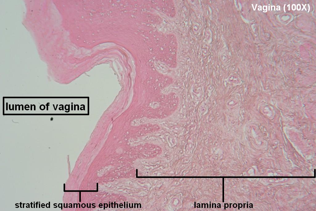 E - Vagina 100X - 1