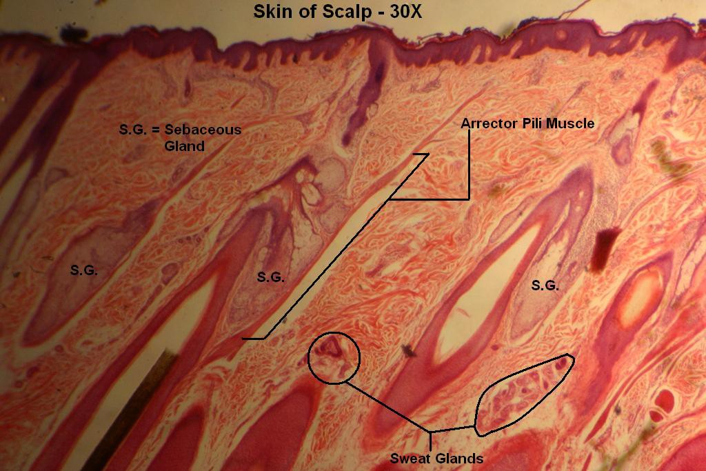 F - Scalp 30X-5