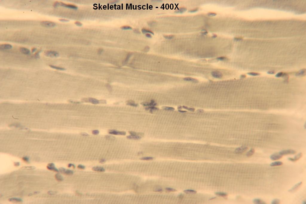 F - Skeletal Muscle Long-Section 400X-3