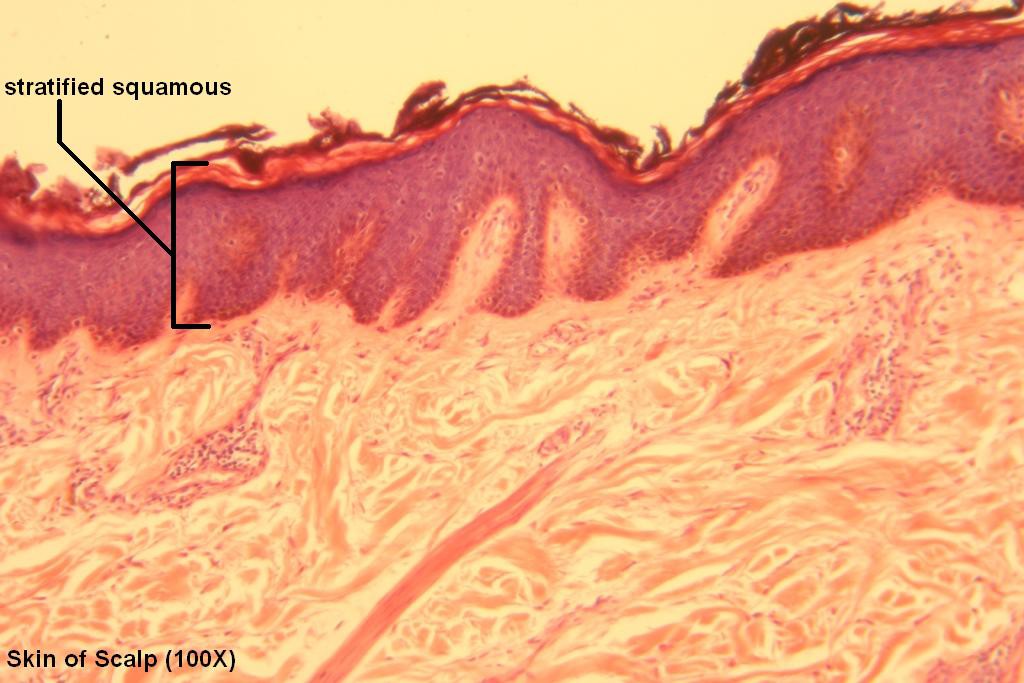F - Stratified Squamous 100X - 4