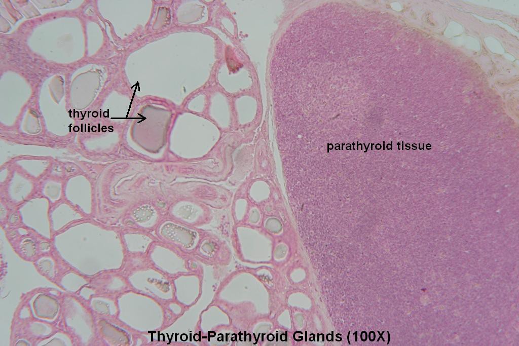 F - Thyroid-Parathyroid 100X - 2