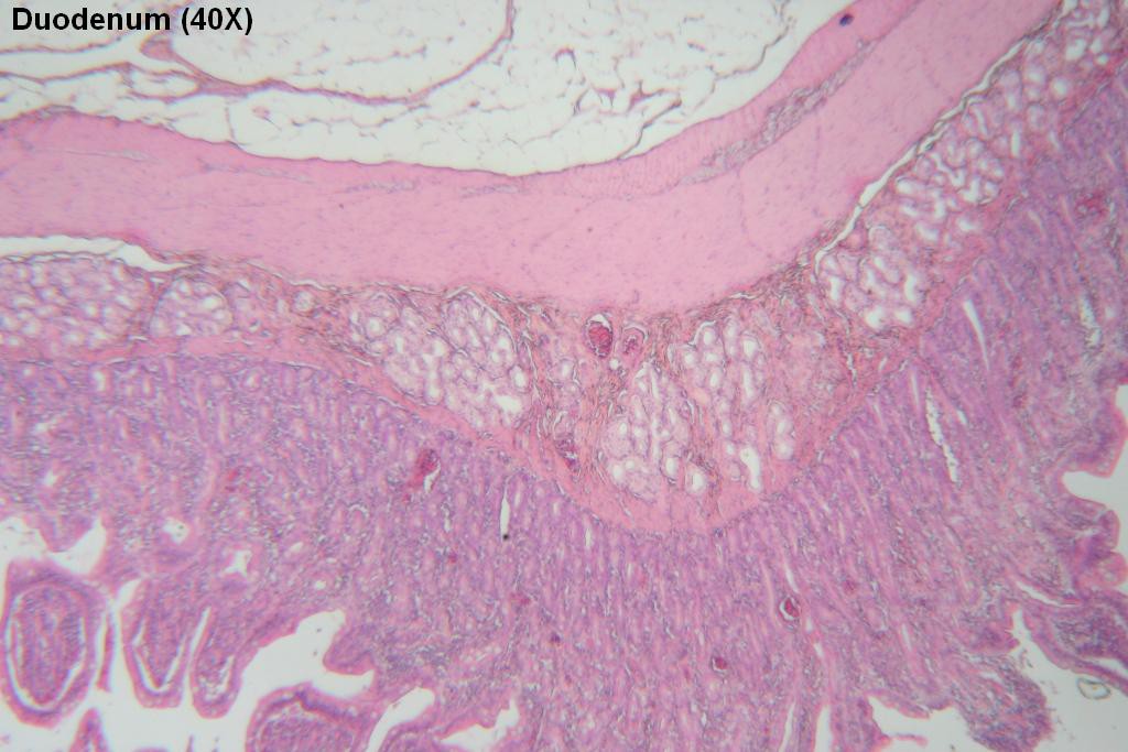 G - Duodenum Wall 40X - 4