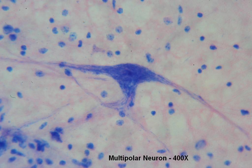 G - Multipolar Neurons 400X - 4