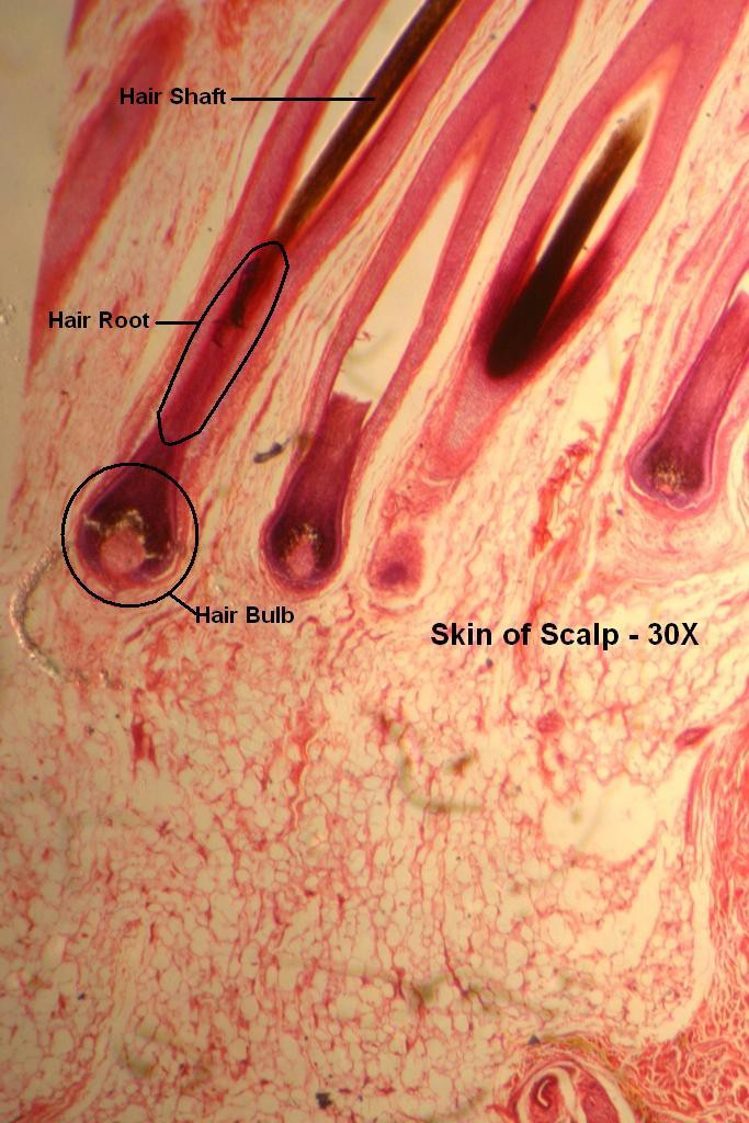 G - Scalp 30X-6-Hair Follicle Regions