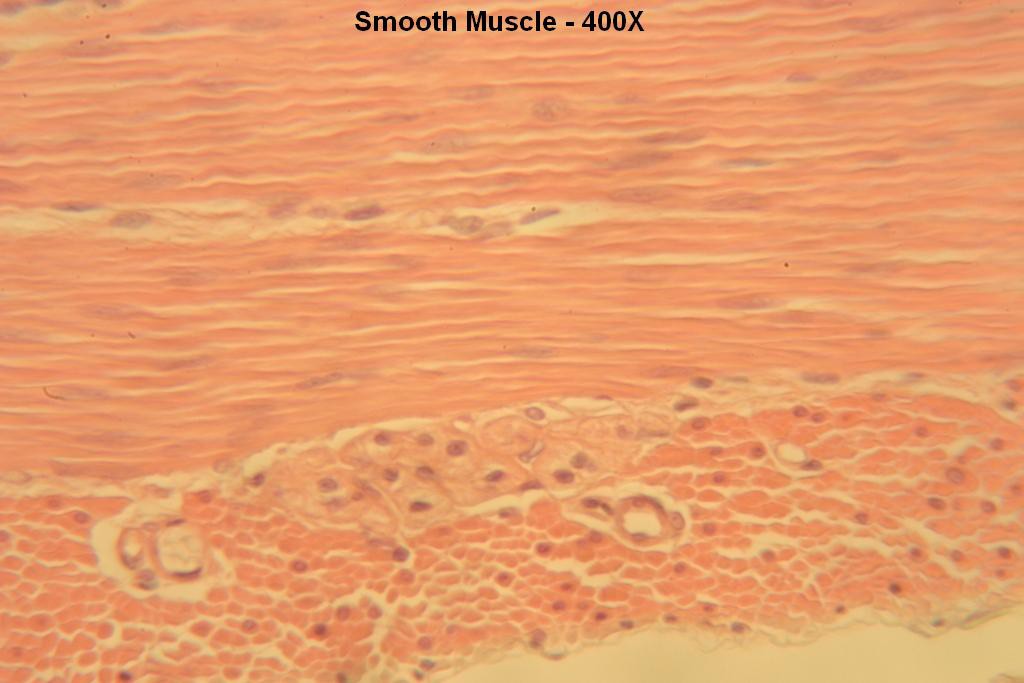 G - Smooth Muscle 400X-1b