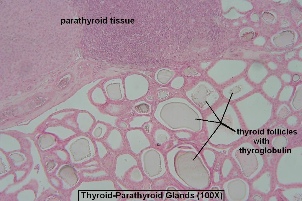 G - Thyroid-Parathyroid 100X - 3