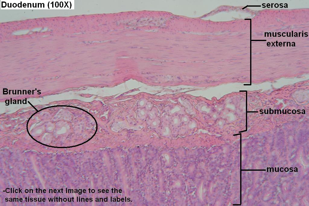 H - Duodenum Wall 100X - 1