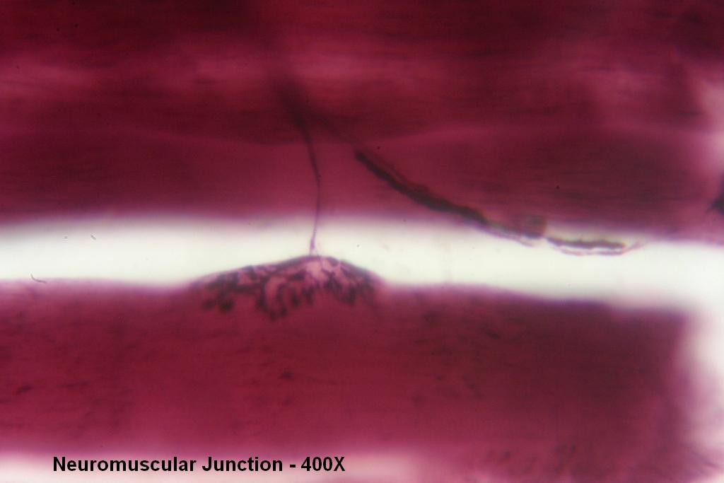H - Neuromuscular Jxn 400X-3
