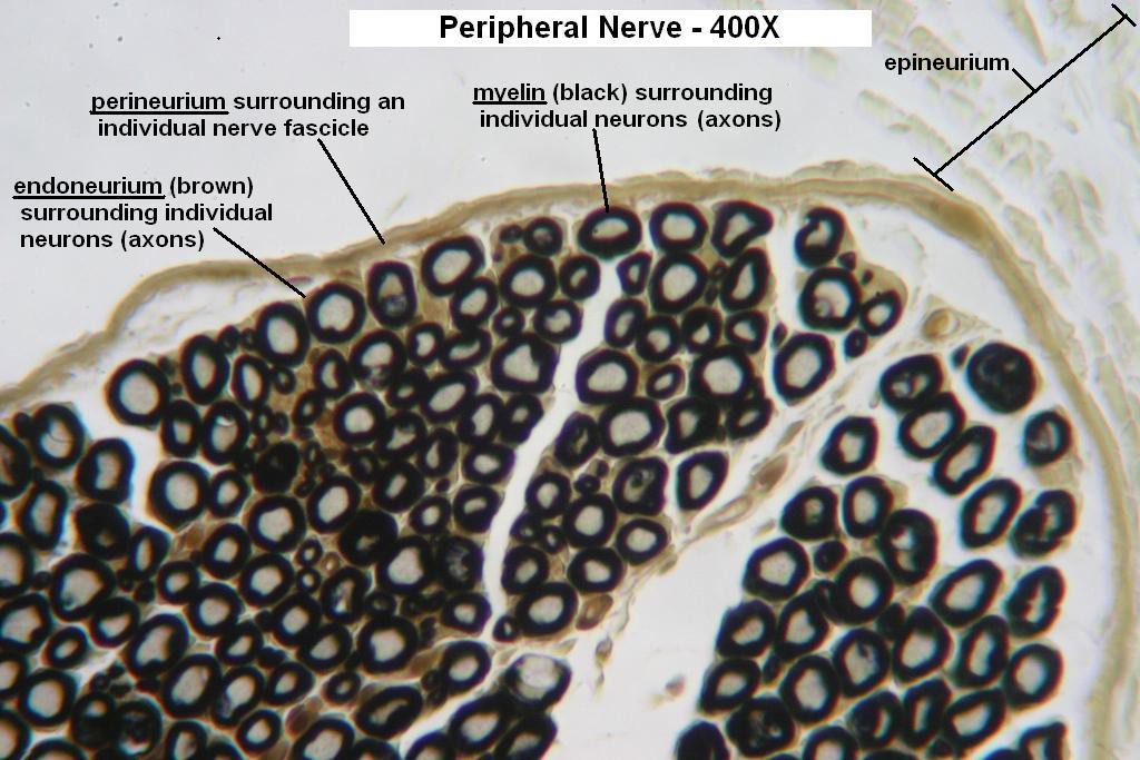 H - Peripheral Nerve 400X - 1