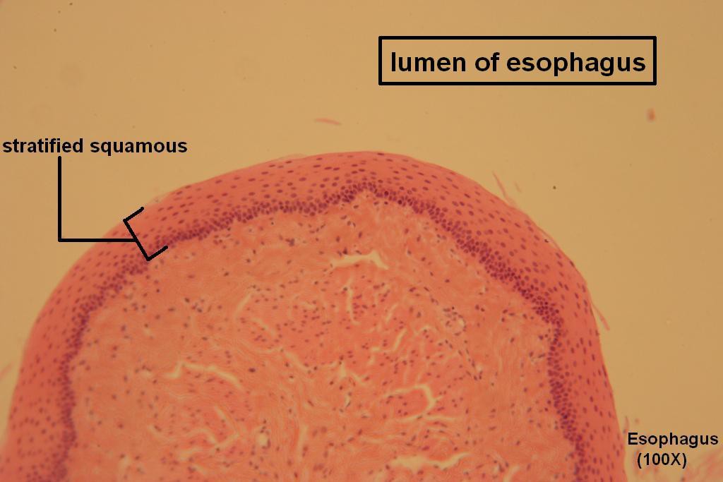 H - Stratified Squamous 100X - 6