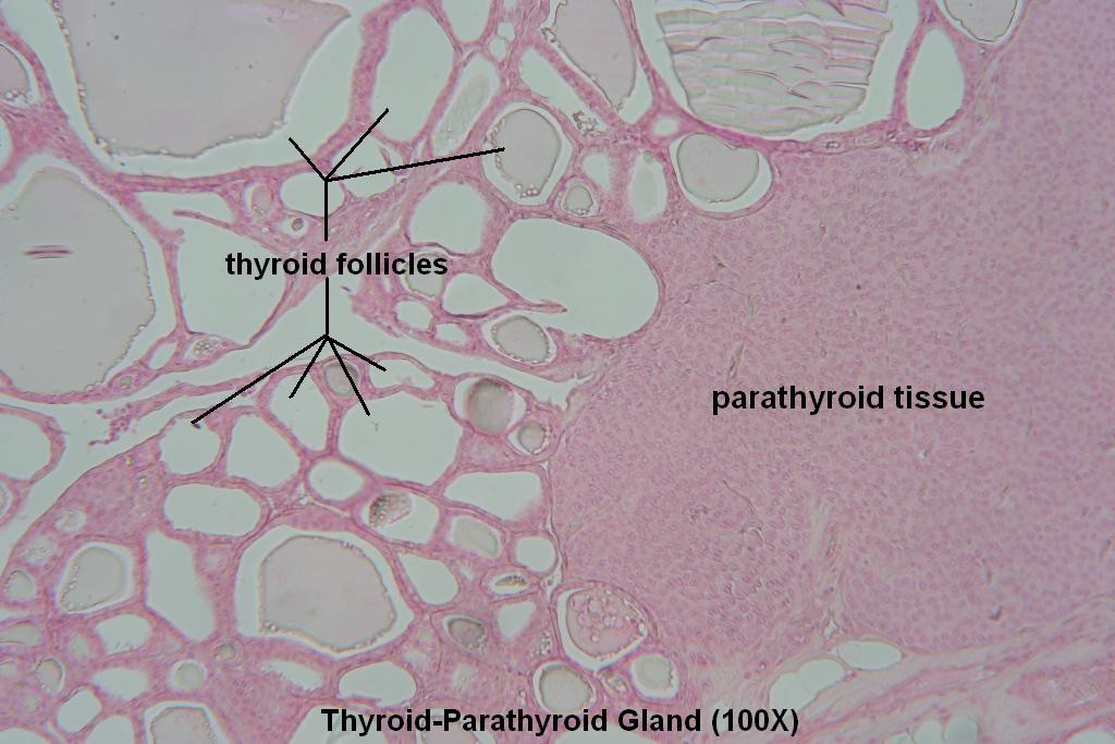 H - Thyroid-Parathyroid 100X - 4