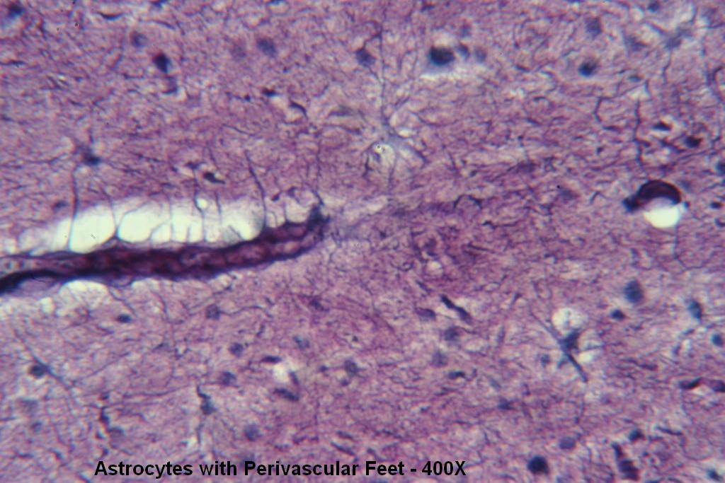 I - Astrocytes with Perivascular Feet 400X - 4