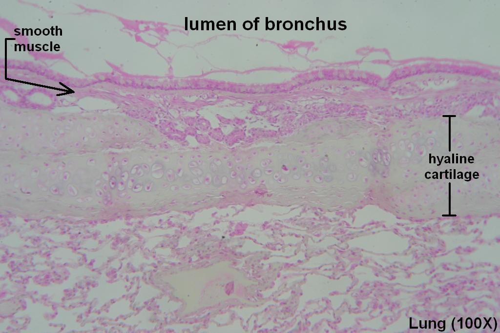 I - Bronchus 100X - 3