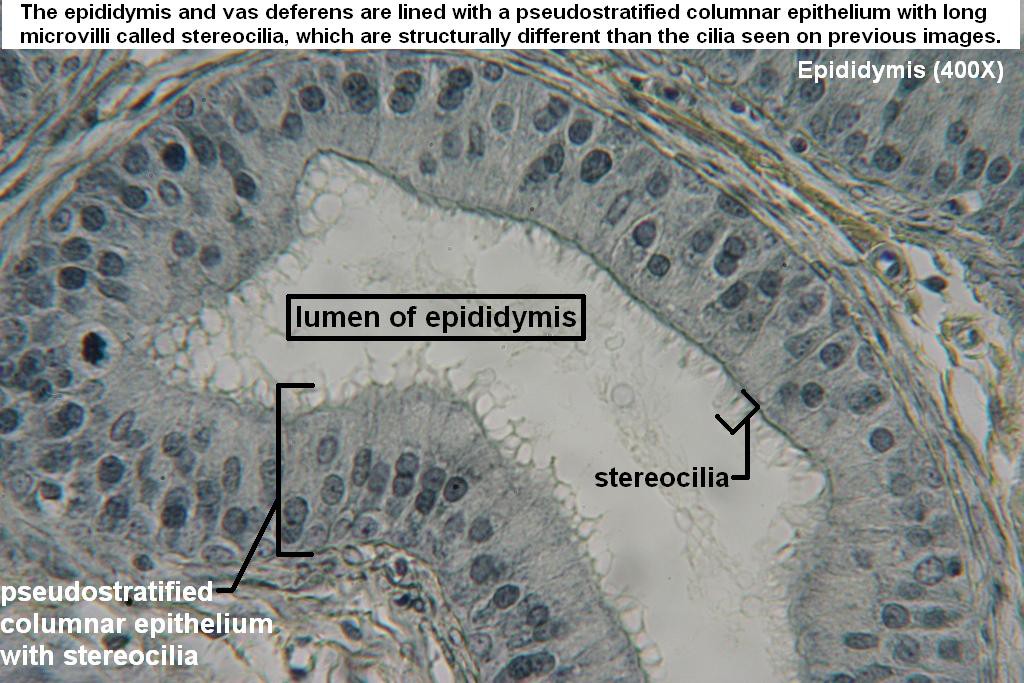 I - Pseudostratified Stereociliated Columnar 400X - 1