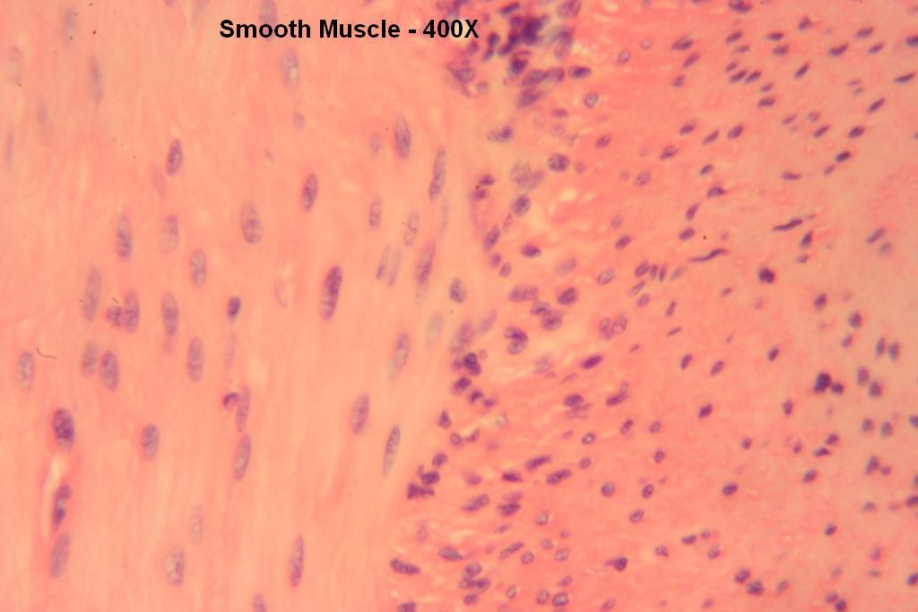 I - Smooth Muscle 400X-3