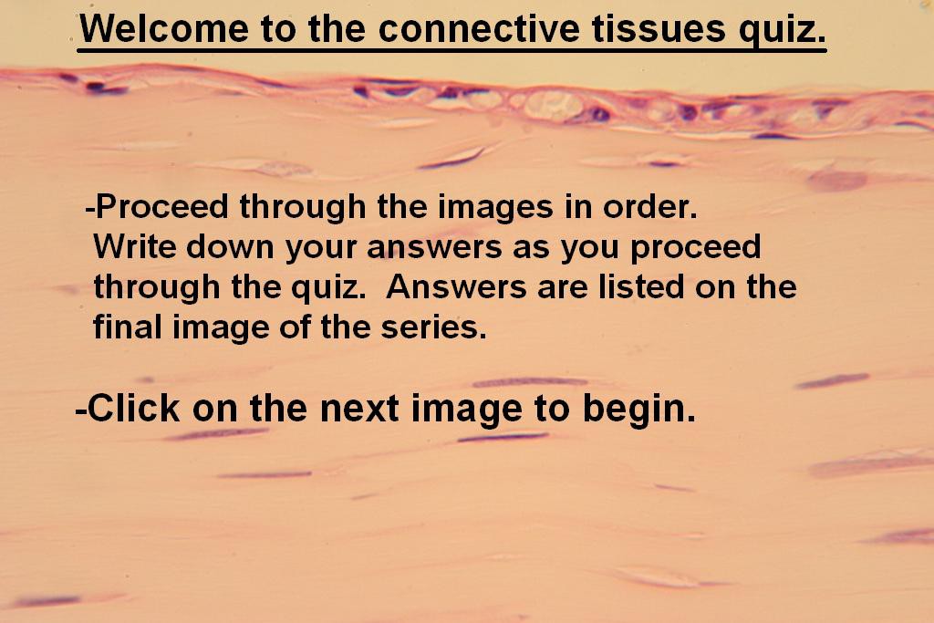 Image A - Connective Quiz