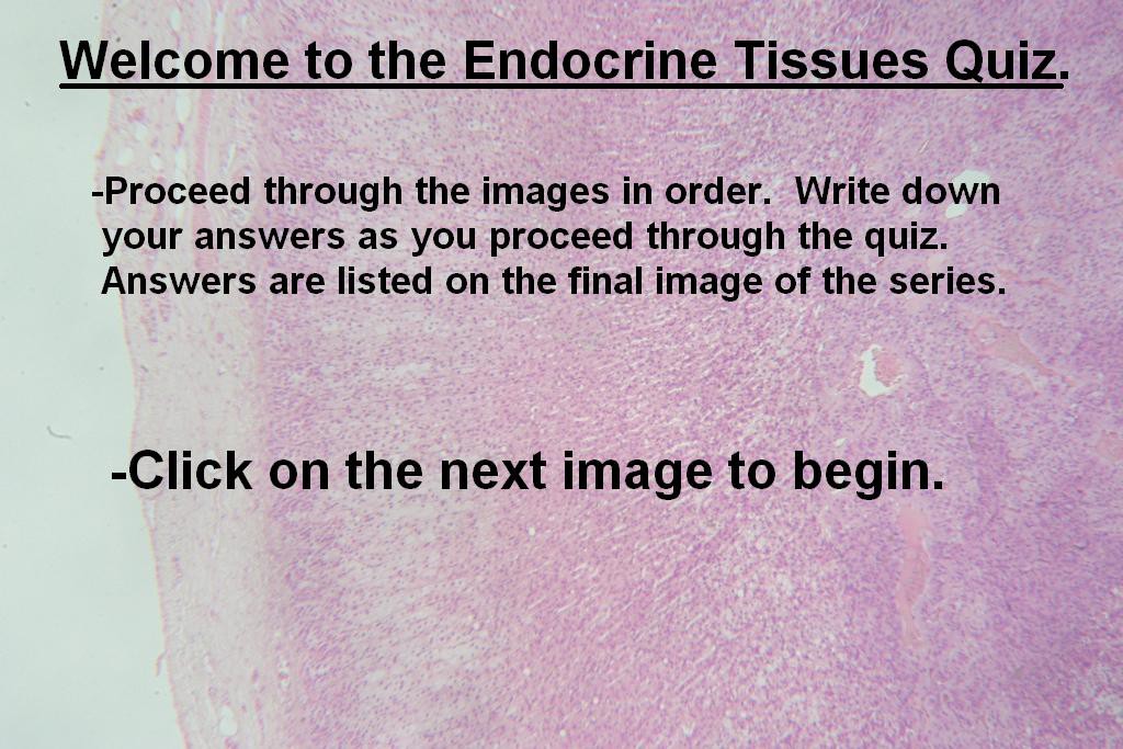 Image A - Endocrine Quiz