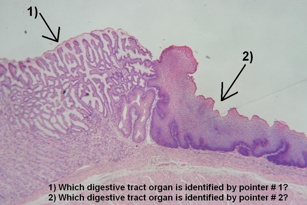 Image B - Digestive System Quiz