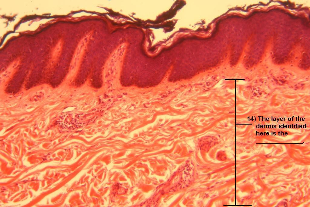 Image H - Integument Quiz