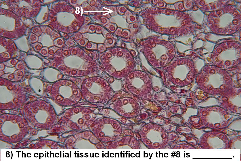 Image I - Epithelial Quiz