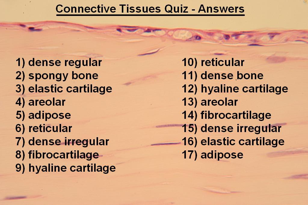 Image S - Connective Quiz - Answers