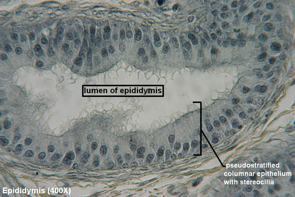 J - Pseudostratified Stereociliated Columnar 400X - 2