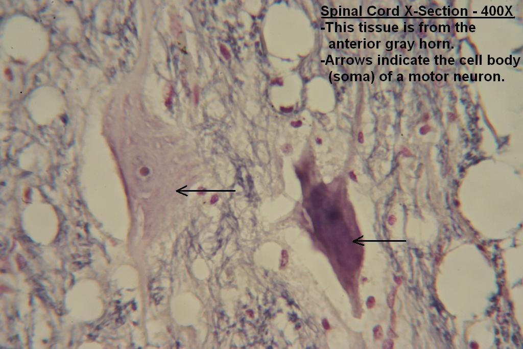 J - Spinal Cord X-Section - Gray Matter - 400X - 2