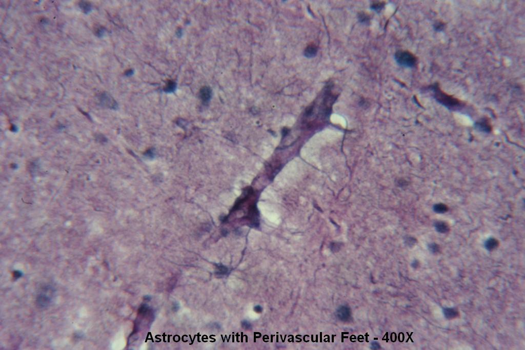 K - Astrocytes with Perivascular Feet 400X - 6